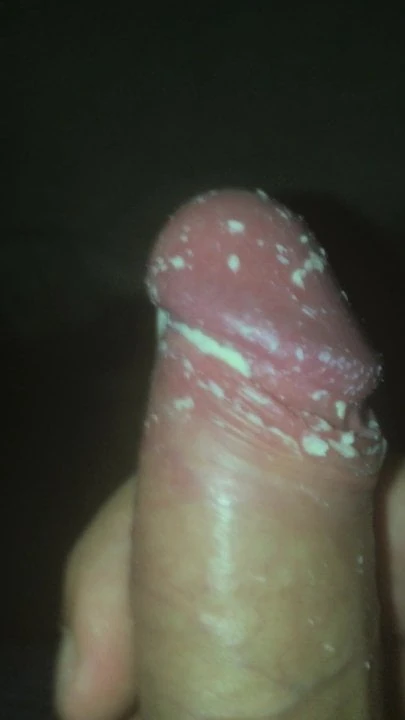 unwashed cheese smegma dick