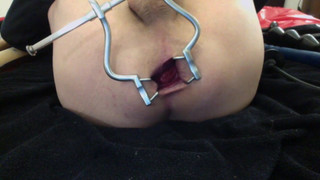 Anal Speculum 3