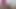 Lizzy Yum July 2023 JUST a SEXUAL MANIC Post-Op Orgasm Pussy Clit Masturbation