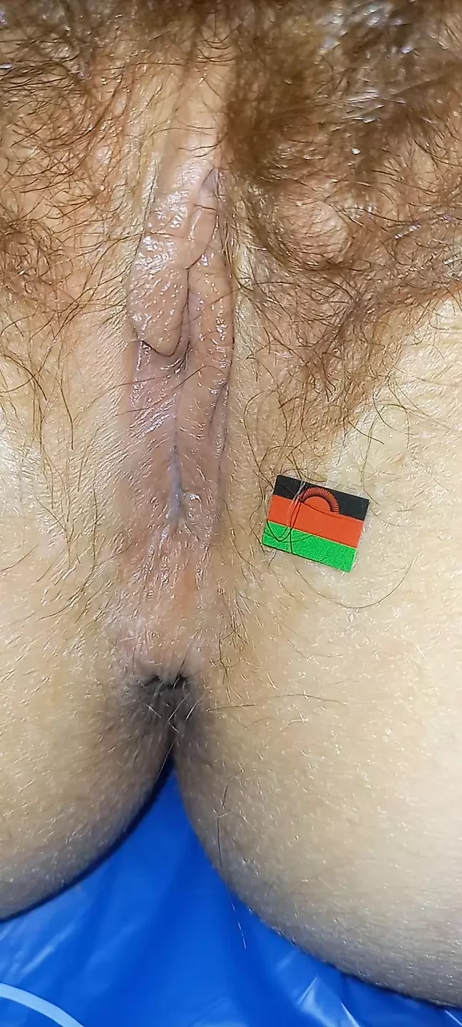 Malawi