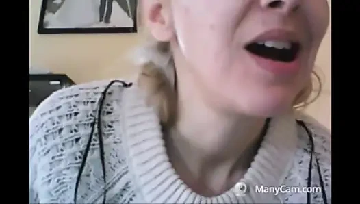 Chantals zähne fallen auseinander, rotten und schwarz