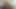 LizzyYum January 20 2024 DYE 03 Post Op Orgasm Pussy anal Masturbation Teasing