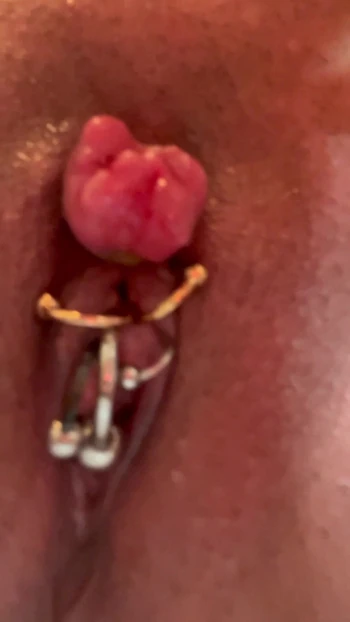 Enlarged clitoris bind