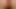 Extreme Anal Fisting, Gaping and Huge Rosebudprolapse