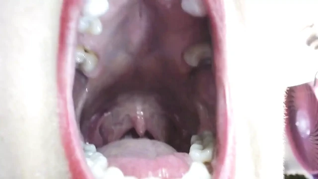 Inside My Big Mouth Tongue Teeth Uvula