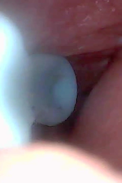 Mari Kita Mengintip Pepek Berair Saya Bersama-sama (Kamera endoscope)