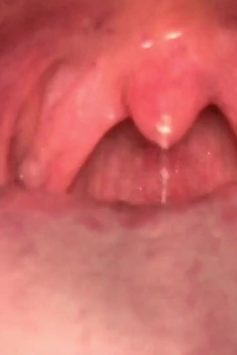 Uvula Fetish