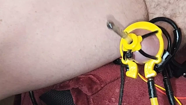 Estim , hfo  filling the probe while cumming