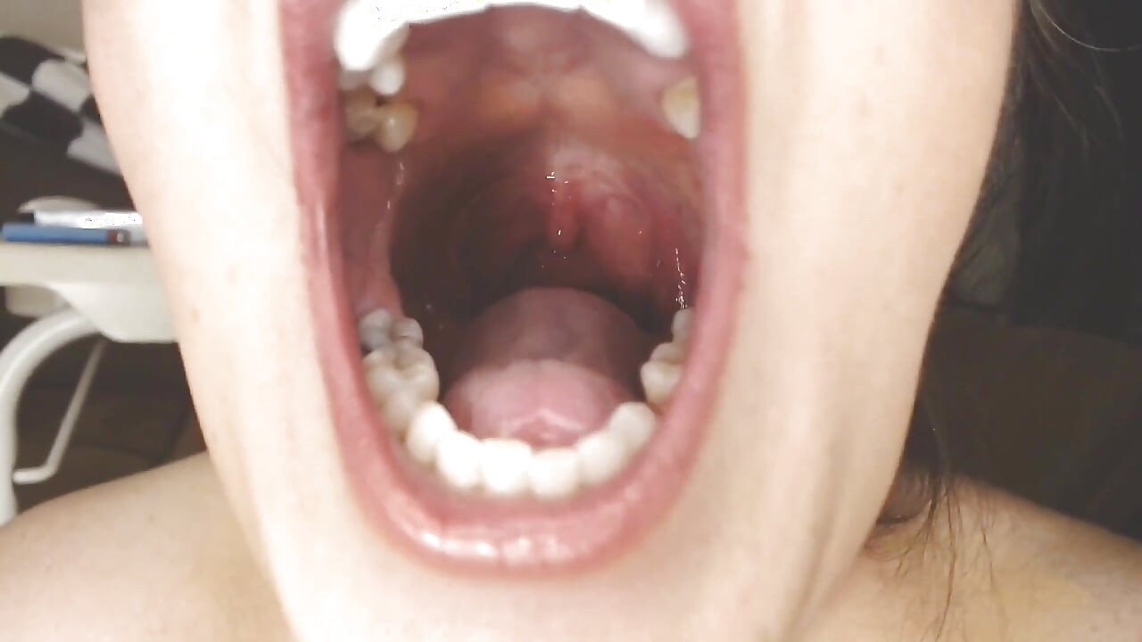 Throat and Mouth Spit Strings Uvula Tonsils Uvula