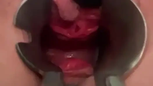 Я и мое гинекологическое зеркало