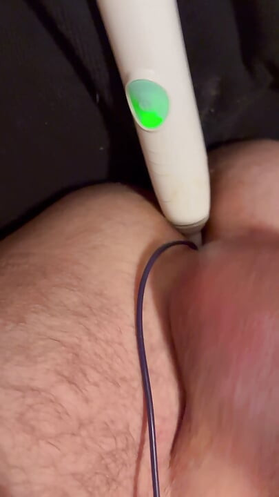 Prostatımı fırçalıyorum