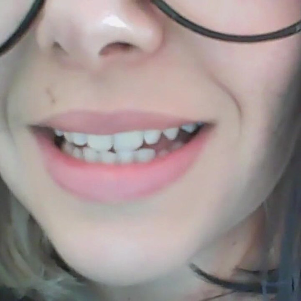 Bạn đã ngạc nhiên một lần nữa eh ?!