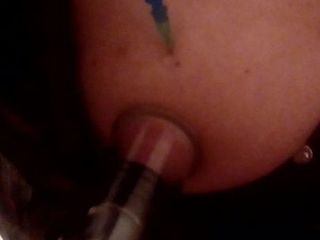 Injeksi payudara