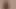 艶をかけられた敗者