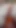 urethra | Clip 3