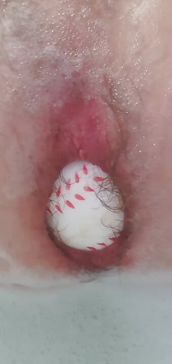 Analball meinen arsch