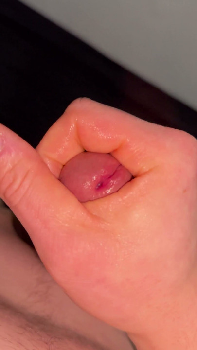 Inserted Dilator Ejaculation | Clip 1