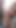 "Ateşli ranu erkek arkadaşıyla doğum odasında romantik video" dan çarpıcı an