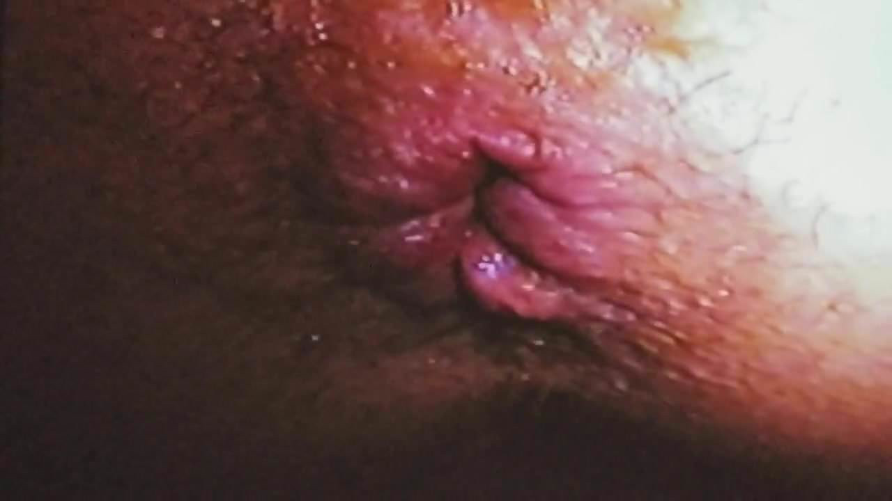Gape that ass open