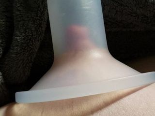 Nipple suctioned hard by breast pump