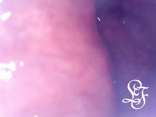 Exploring the Depths of my Ass with the Minicam!