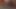 Lizzy Yum VR August 2023 CLOSE UP post op orgasm pussy masturbation teasing