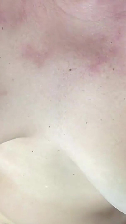 Epic moment from "Chubby Ass destroyed. Close up anal. Anal Gaping. Hairy Pussy. Amateur Anal. MILF Anal. Hairy Asshole"