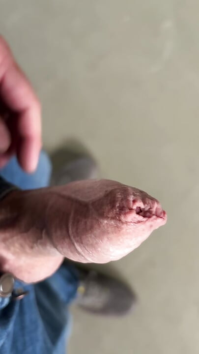 Uncut forskin