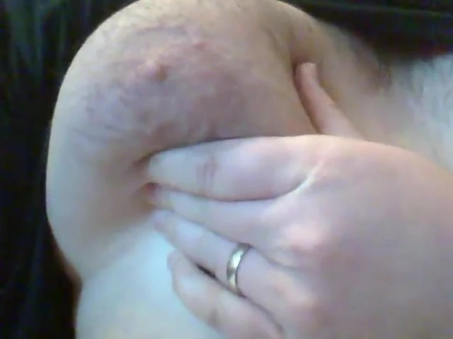 my moobs