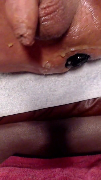 Pregled videozapisa
