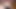 Crazy Cam Girl Viewer