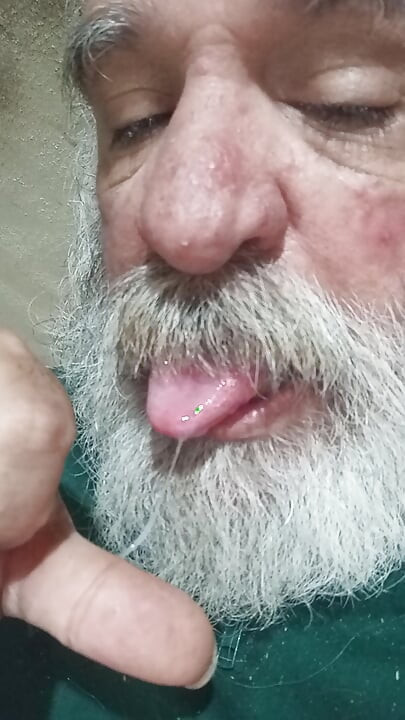 לייט מאקרו פין