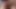 Megaculona Teasing