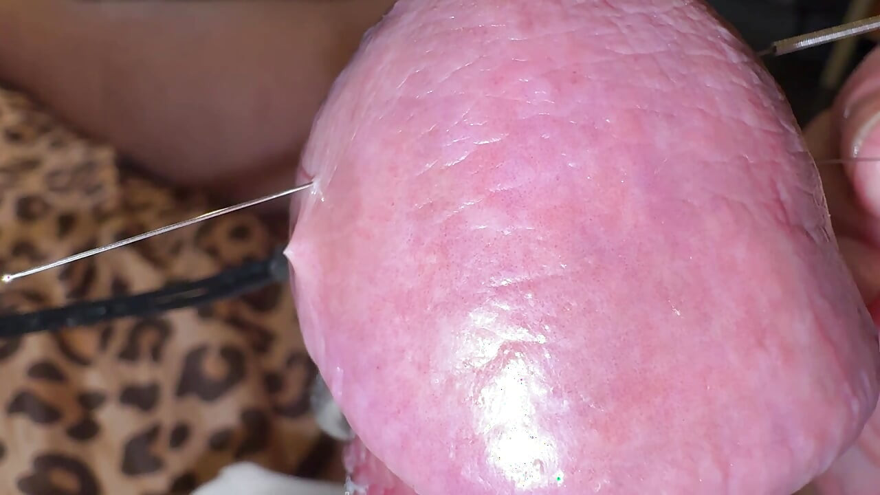Needles through the hard glans!