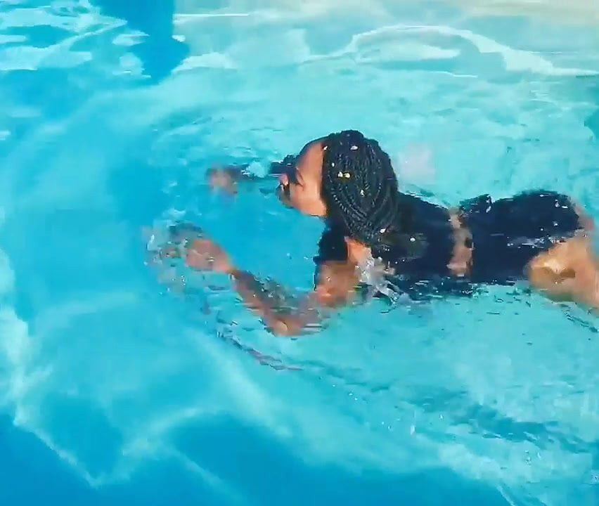amputee