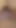 Dev penis komşunun anüsünü kırıyor