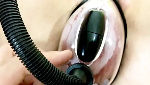 Vakum pompasının etkisi altında vajinal deformasyon