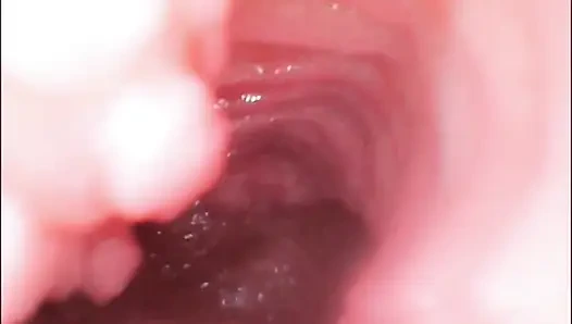 Endoskop dölleme. Amcık içindeki kamera yarağın amının içine boşalğını gösteriyor