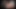 Young Skinny Girl with Huge Nipples Fucked and Cumshot in Mouth by a Big Cock