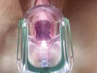 Stella St. Rose - extrema escancarada, veja meu close-up do colo do útero usando um espéculo