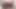 amateur outdoor transvestite sounding urethral lingerie exte