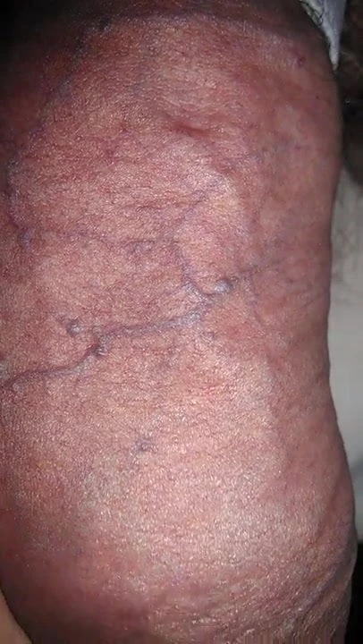 cbt23