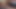 C95 Matte mit langen Nippeln 3