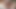 Postop Ladyboy Bomb Creampie Ride