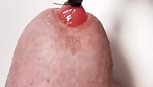 Üretrada top