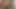 LizzyYum January 2023 JUST MY VAGINA Post Op Orgasm Pussy Masturbation Teasing