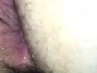 Hairy Hole