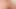 Xxxx