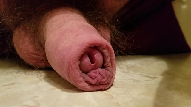 Getting hard, rolling skin