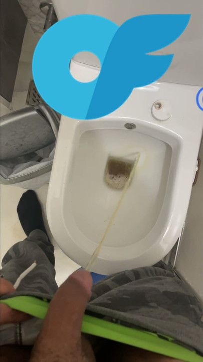 Urine Collection
